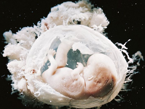 怀孕15周胎儿图图片